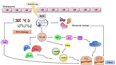 Status of Treatment and Prophylaxis for Radiation-Induced Oral Mucositis in Patients With Head and Neck Cancer